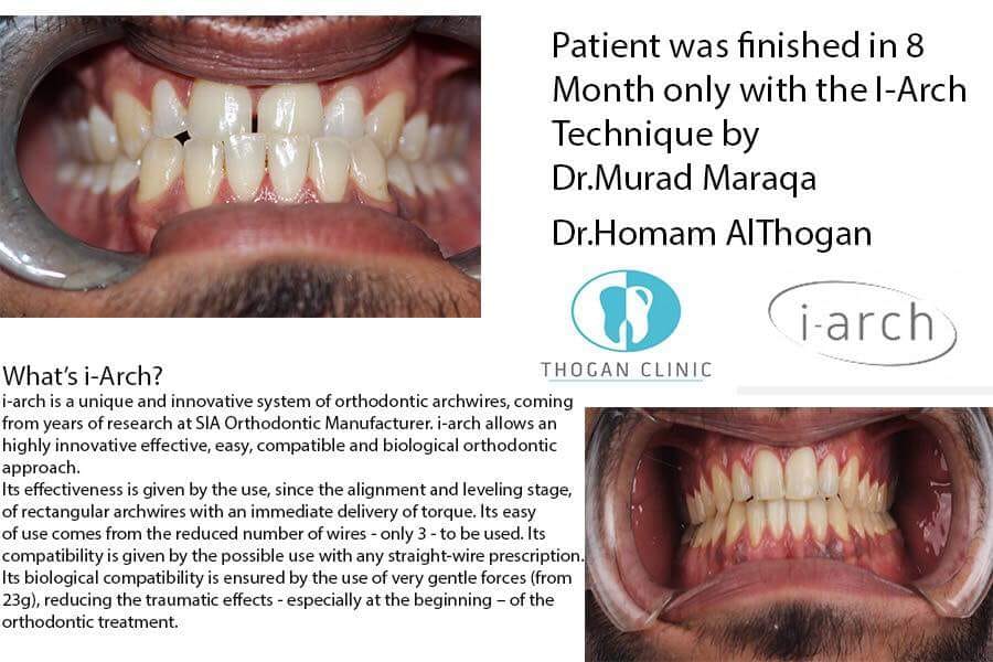 i-Arch - case report - ZOOM - prima pagina a catalogului